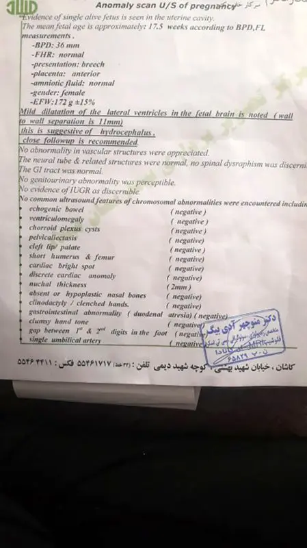 آب آوردن سر جنین، امکان هیدروسفالی چقدره؟