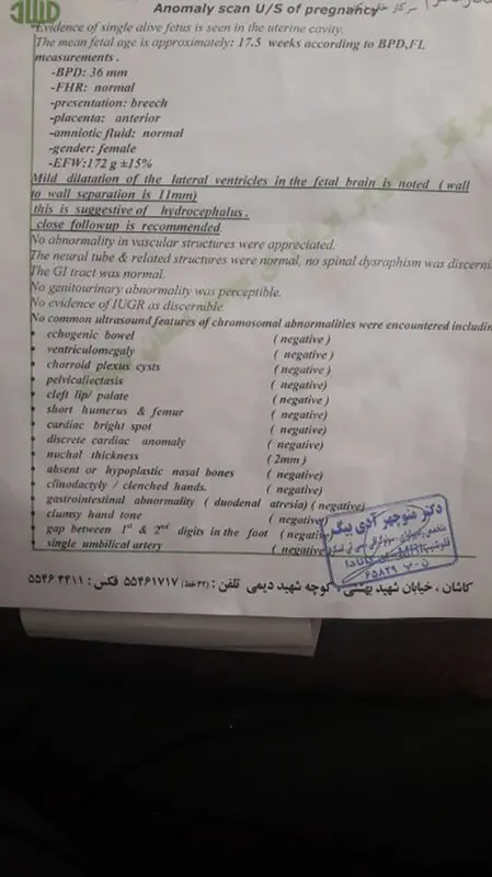 آب آوردن سر جنین، امکان هیدروسفالی چقدره؟