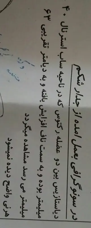 ناف بعد از زایمان، علت بیرون زدگی