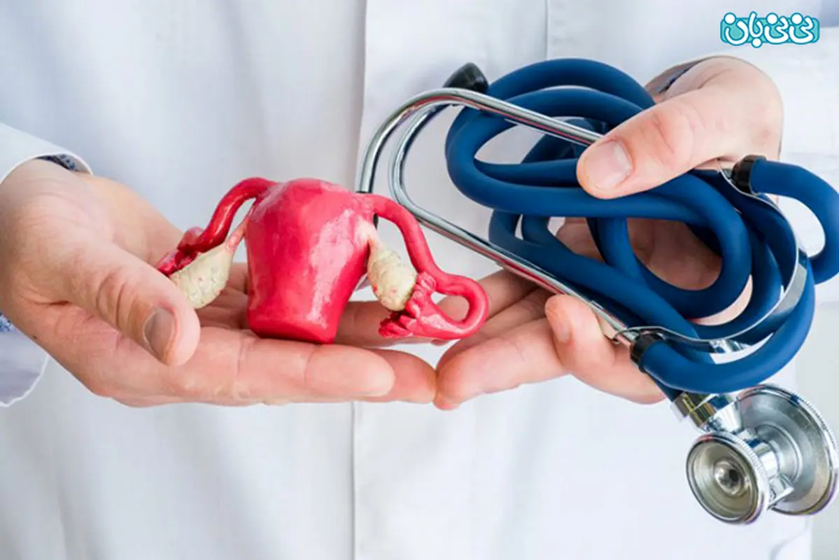 اطلاعاتی در مورد اندومتریوز، سیر تا پیاز ماجرا