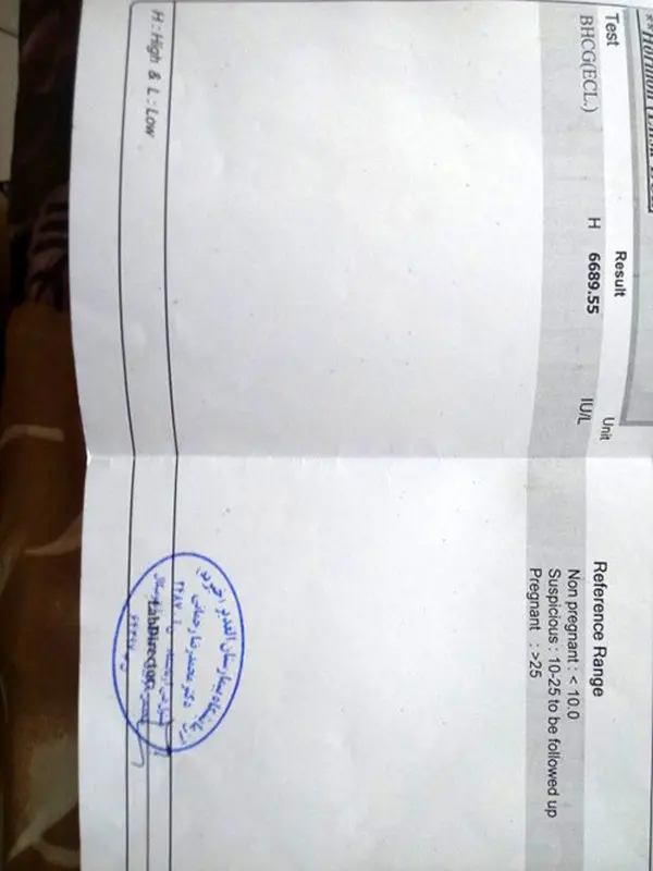 آزمایش بتا دادم، مقدارش طبیعیه؟