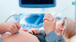 چه زمانی برای اولین سونوگرافی بارداری مناسب است؟