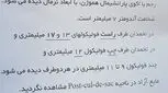 فولیکول برای پسردار شدن، باید چند باشه؟