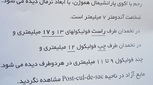 فولیکول برای پسردار شدن، باید چند باشه؟
