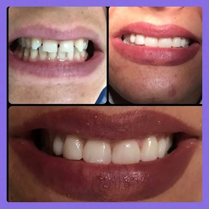 مراقبت از دندان کودک، مرکز دندانپزشکی آریا