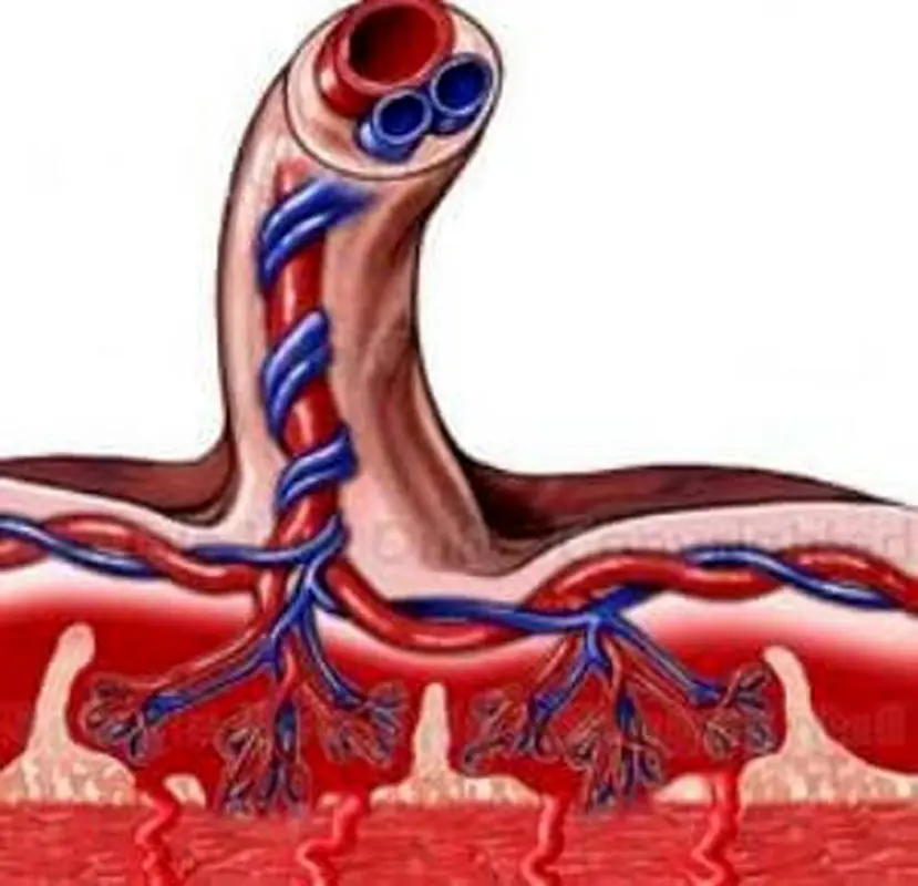 مشکلات بند ناف تک شریانی، چیست؟