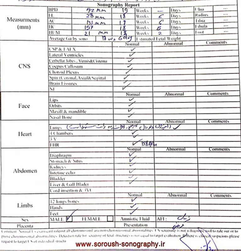 تفسیر آزمایش غربالگری دوم، مشکلی ندارد؟