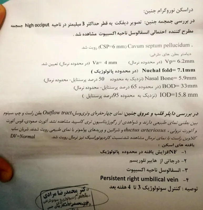 انواع ناهنجاری های جنینی، ممکنه تکرار بشه؟