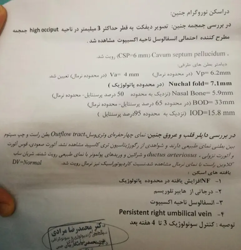 انواع ناهنجاری های جنینی، ممکنه تکرار بشه؟