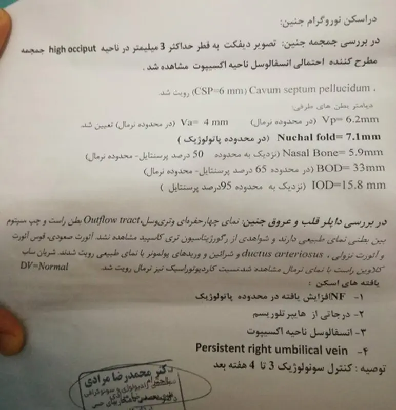 انواع ناهنجاری های جنینی، ممکنه تکرار بشه؟