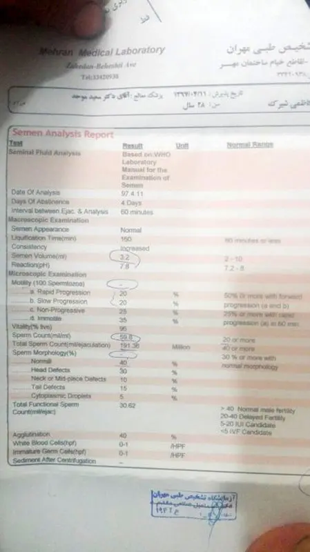 آیا واریکوسل باید عمل شود؟