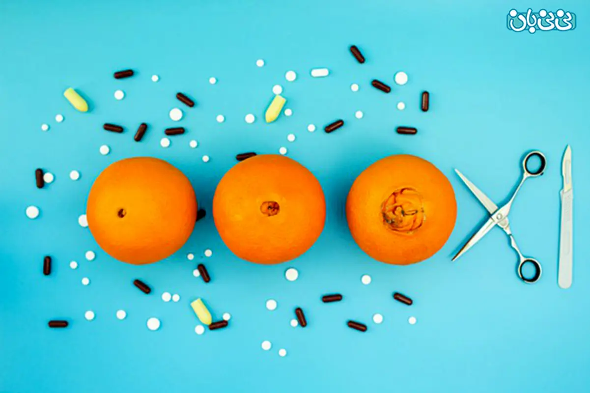 عمل جراحی ماموپلاستی، چگونه انجام میشود؟