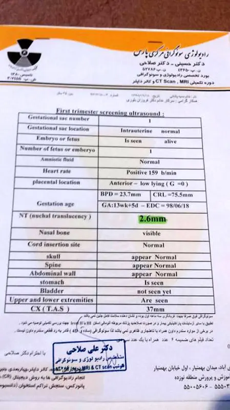 ضرورت انجام آمنیوسنتز، چقدر است؟