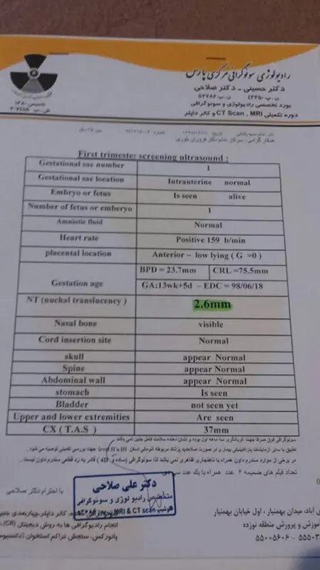 ضرورت انجام آمنیوسنتز، چقدر است؟