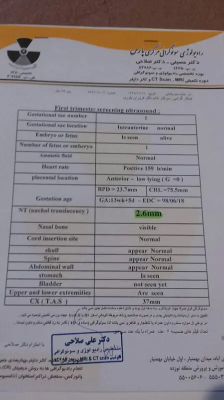 ضرورت انجام آمنیوسنتز، چقدر است؟