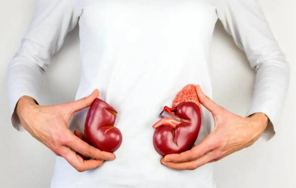 چه بخوریم تا سنگ کلیه نگیریم؟