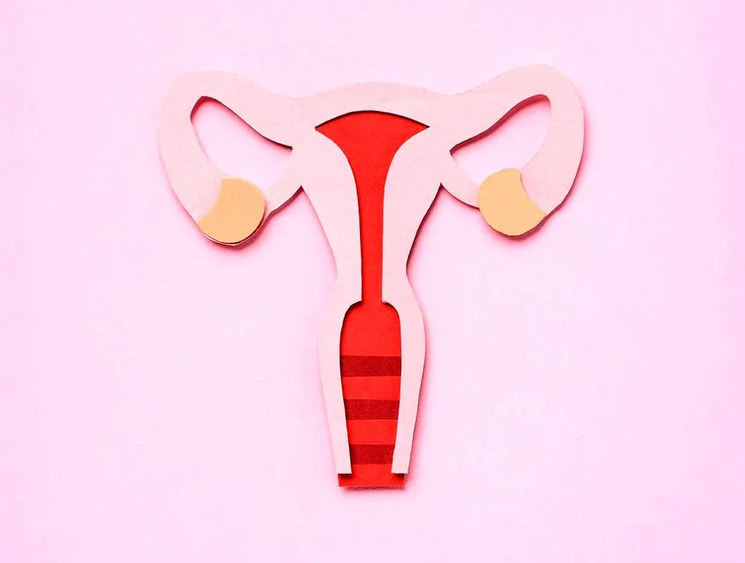 عکس رنگی رحم (HSG)  و نحوه انجام آن