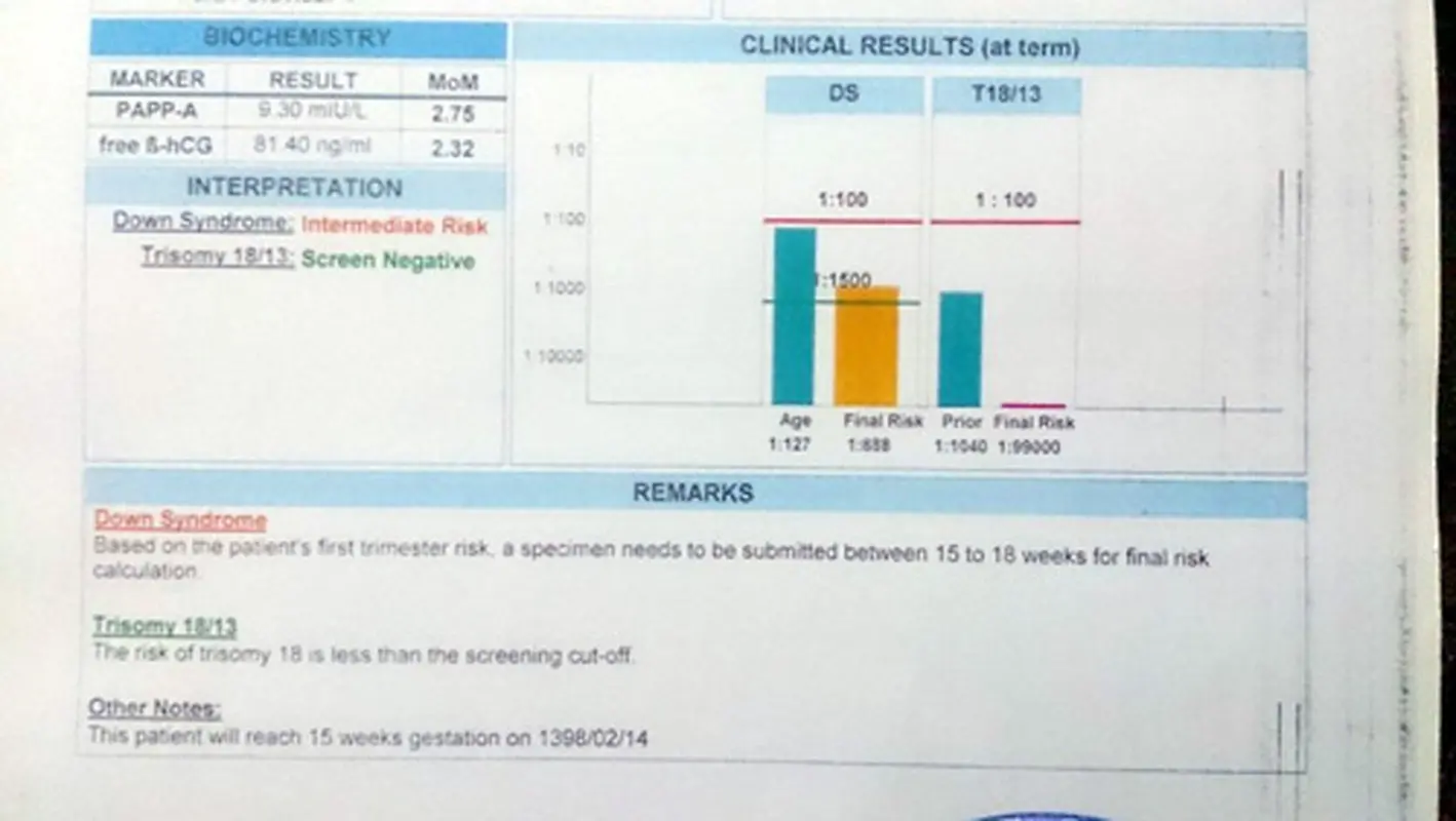 انجام غربالگری اول، نتیجه خوب است؟