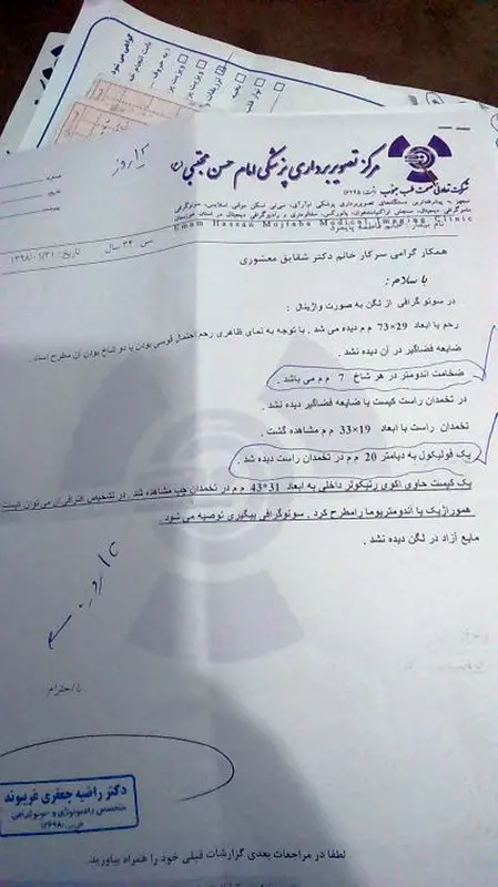 نازایی ثانویه در زنان، چه درمانی دارد؟