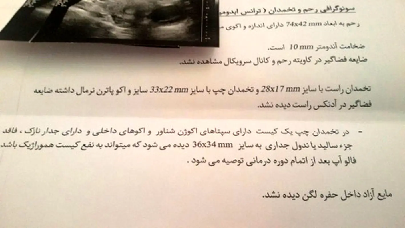 جواب سونو رحم، نتیجه نرمال است؟