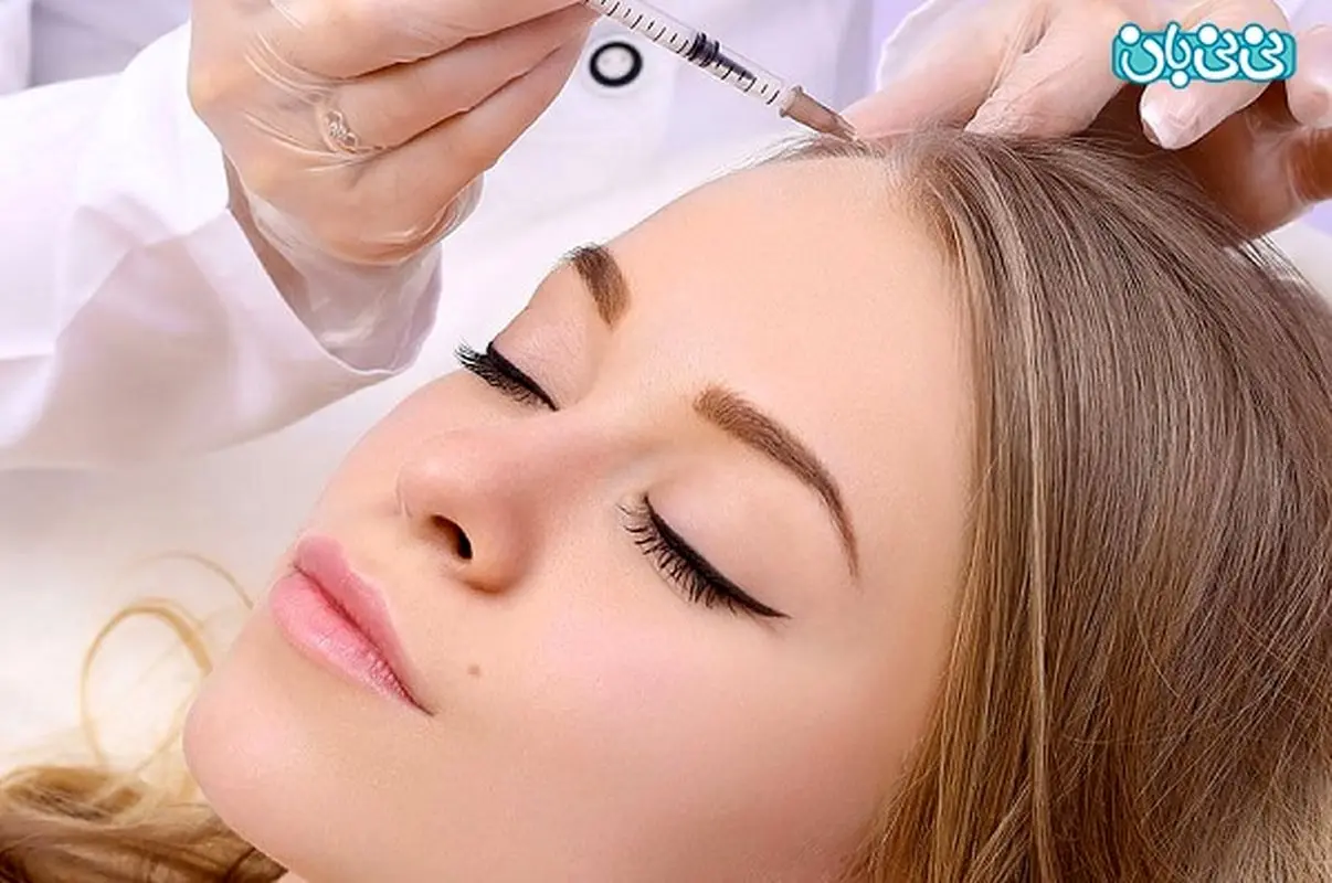 تجربه مزوتراپی مو، چرا؟