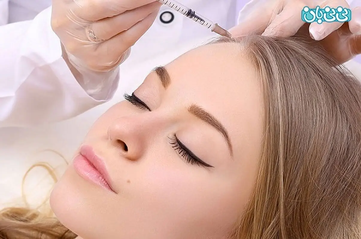 تجربه مزوتراپی مو، چرا؟