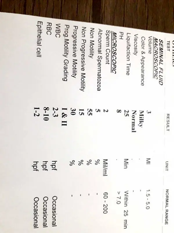 تفسیر آزمایش اسپرم، لطفا راهنمایی کنید