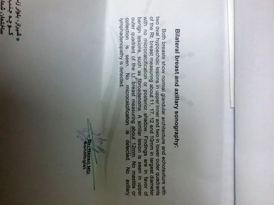 کیست ریز تخمدان، باعث لکه بینی می شود؟