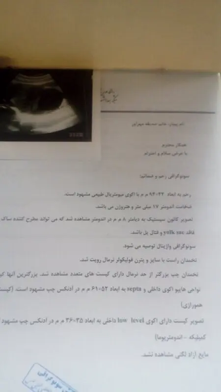 هفته شش بارداری، جواب سونوگرافی نرماله؟