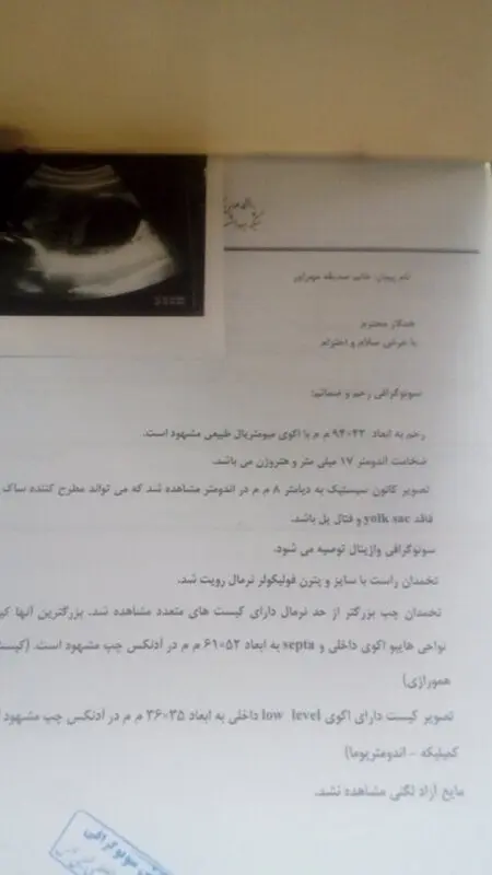هفته شش بارداری، جواب سونوگرافی نرماله؟