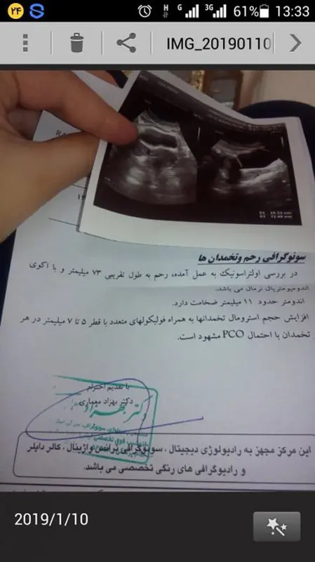 سونوگرافی از رحم و تخمدان، آیا نرمال است؟