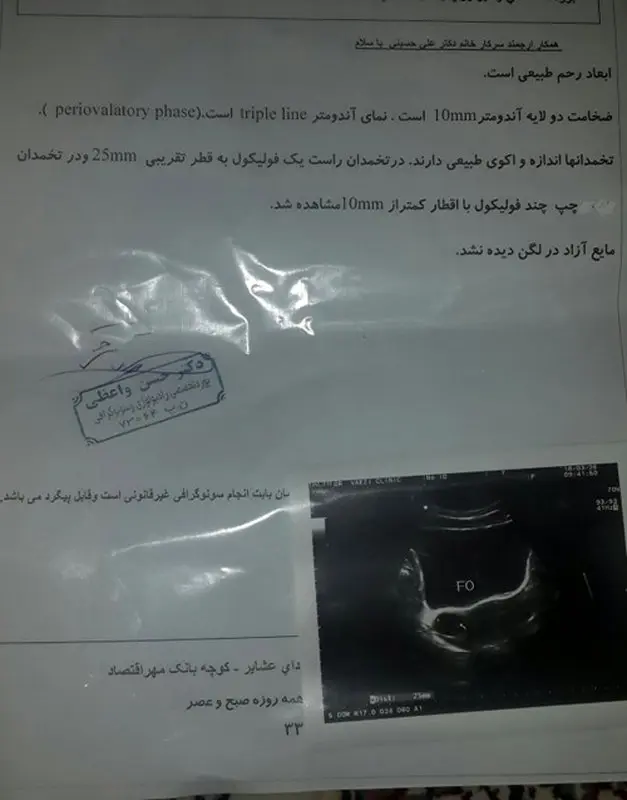 اندازه فولیکول برای بارداری چقدر است؟