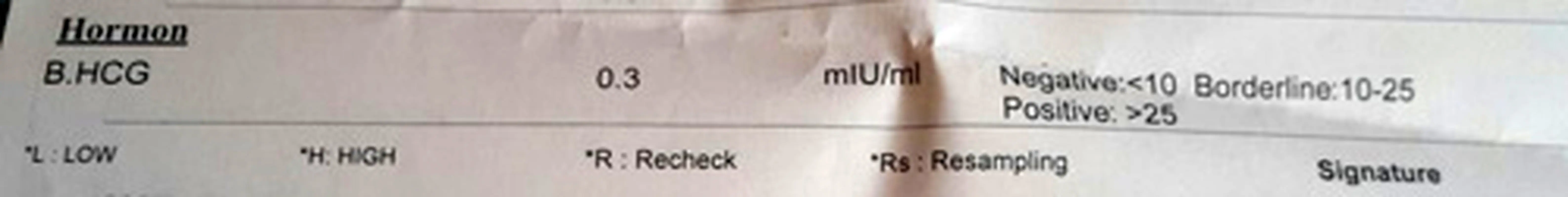 انجام تست بتا، چه کاربردی دارد؟