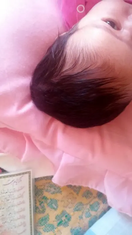 فرم سر نوزاد، آیا تغییر می کند؟