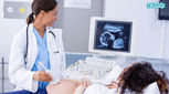 سونوگرافی در دوران بارداری، نکاتی مهم درباره آن