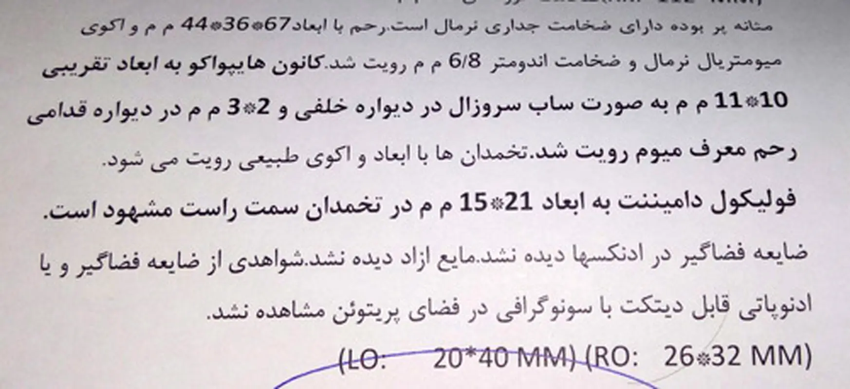 فیبروم رحم زنان، خطرناک است؟