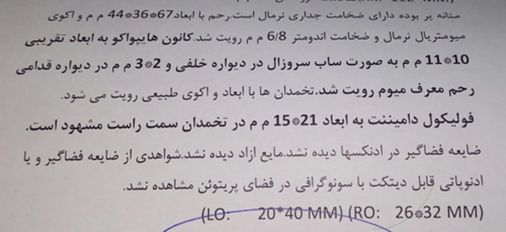 فیبروم رحم زنان، خطرناک است؟