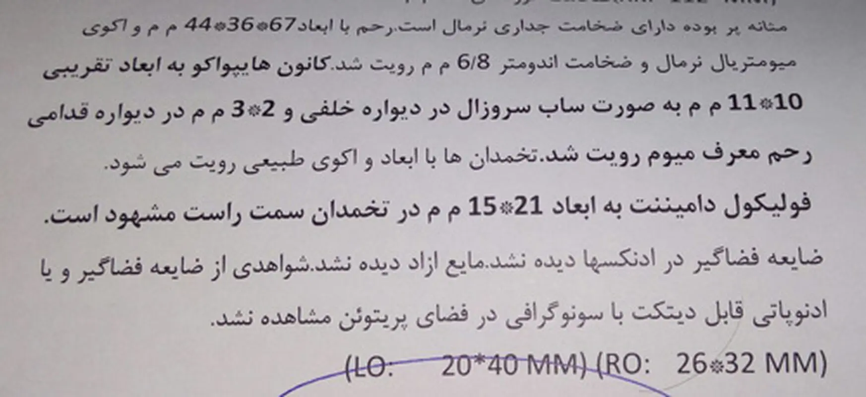 فیبروم رحم زنان، خطرناک است؟