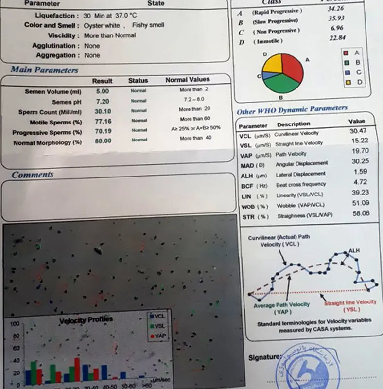 جواب آزمایش اسپرم، نتیجه چگونه است؟