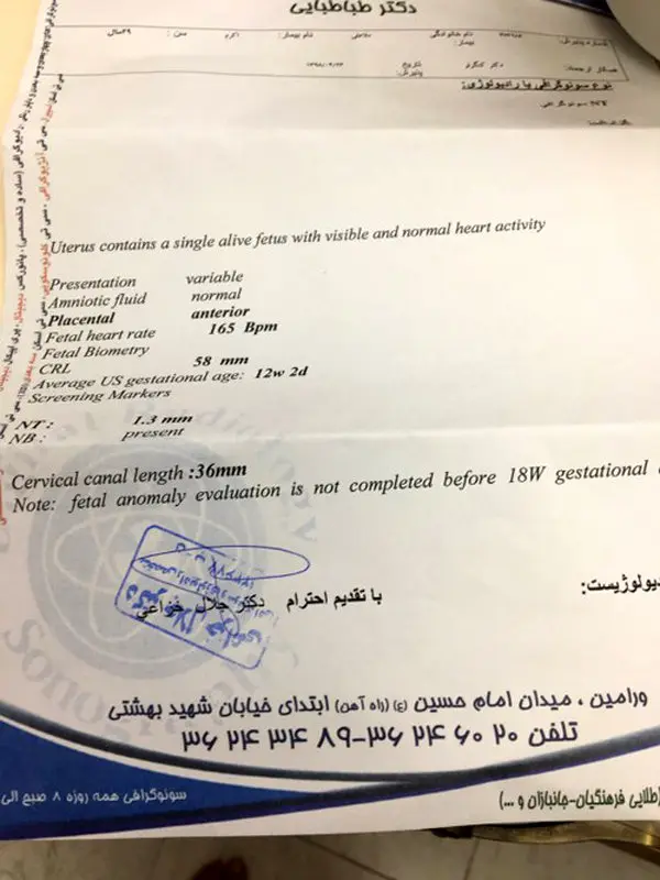 غربالگری دوم بارداری، تفاوت سن جنین در سونوگرافی