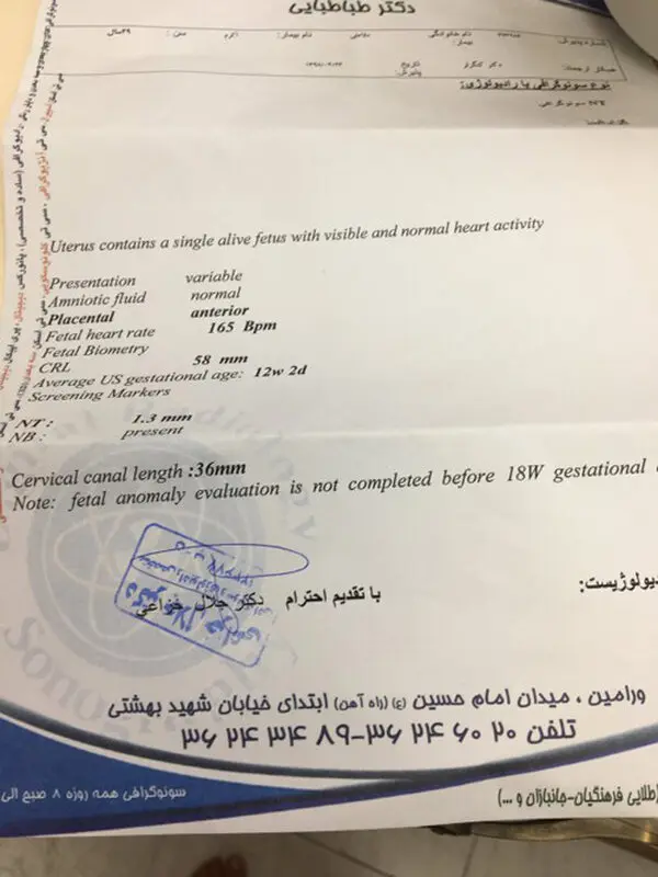 غربالگری دوم بارداری، تفاوت سن جنین در سونوگرافی