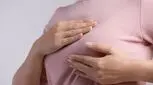۷ علت عدم تقارن پستان ها در زنان