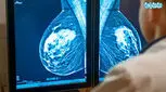 ماموگرافی چگونه است؟