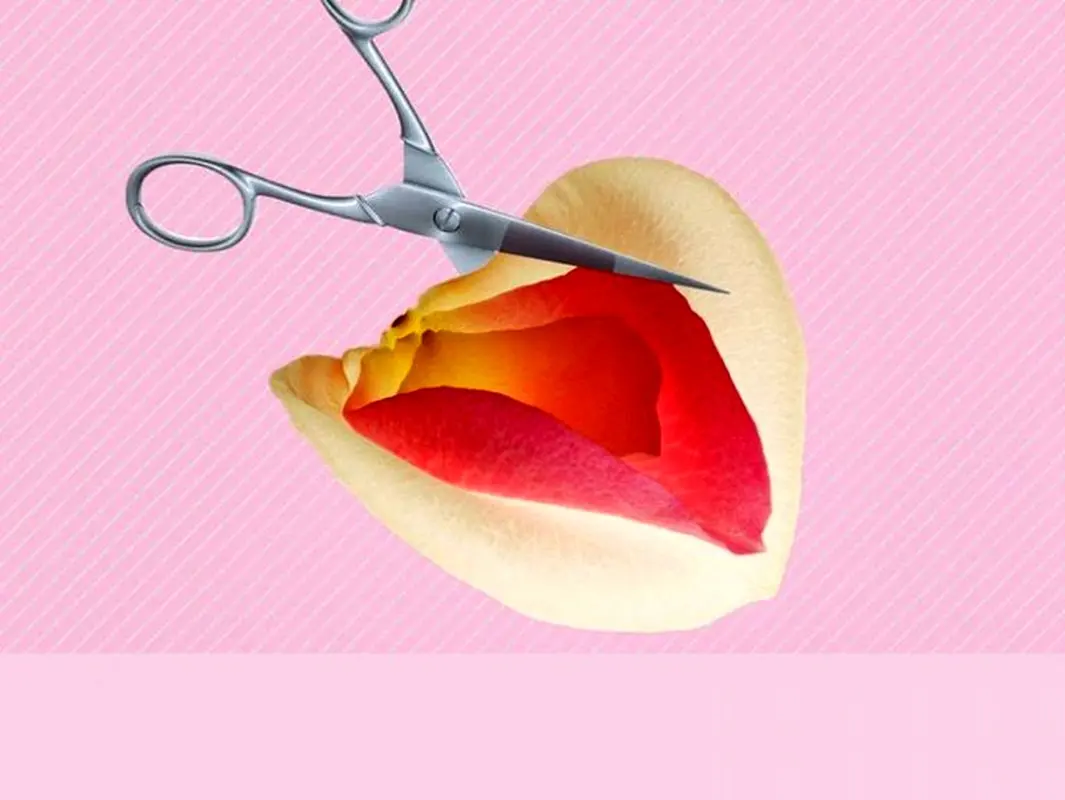 عمل زیبایی واژن، بهترین متخصصان حوزه زنان