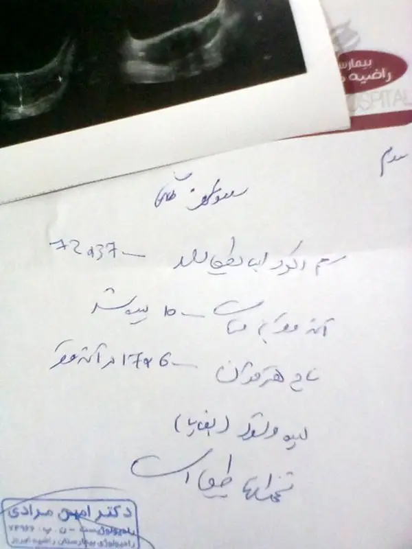 ال دی بعد از سقط، باعث دفع بقایا میشود؟