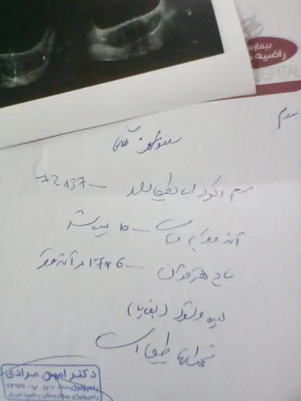 ال دی بعد از سقط، باعث دفع بقایا میشود؟