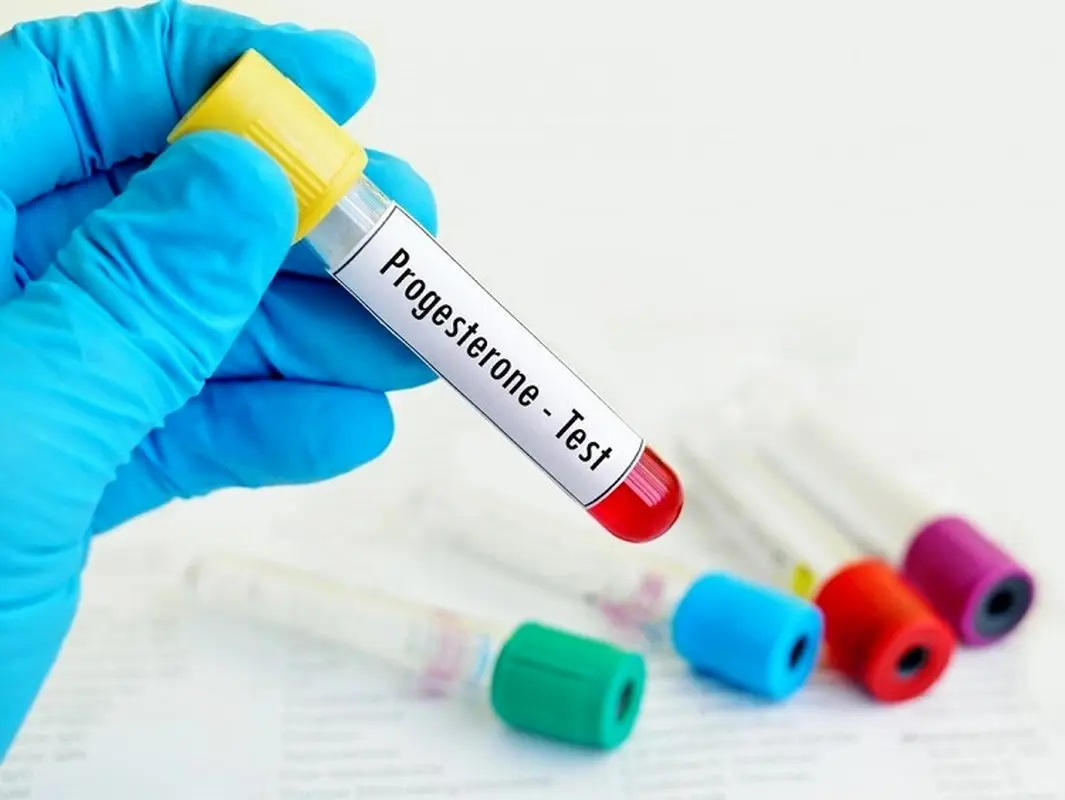 آزمایش پروژسترون (Progesterone) سرم چیست؟ 