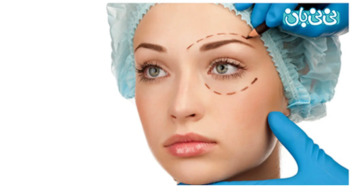 جراحی پلک چیست، هزینه آن چقدر است؟