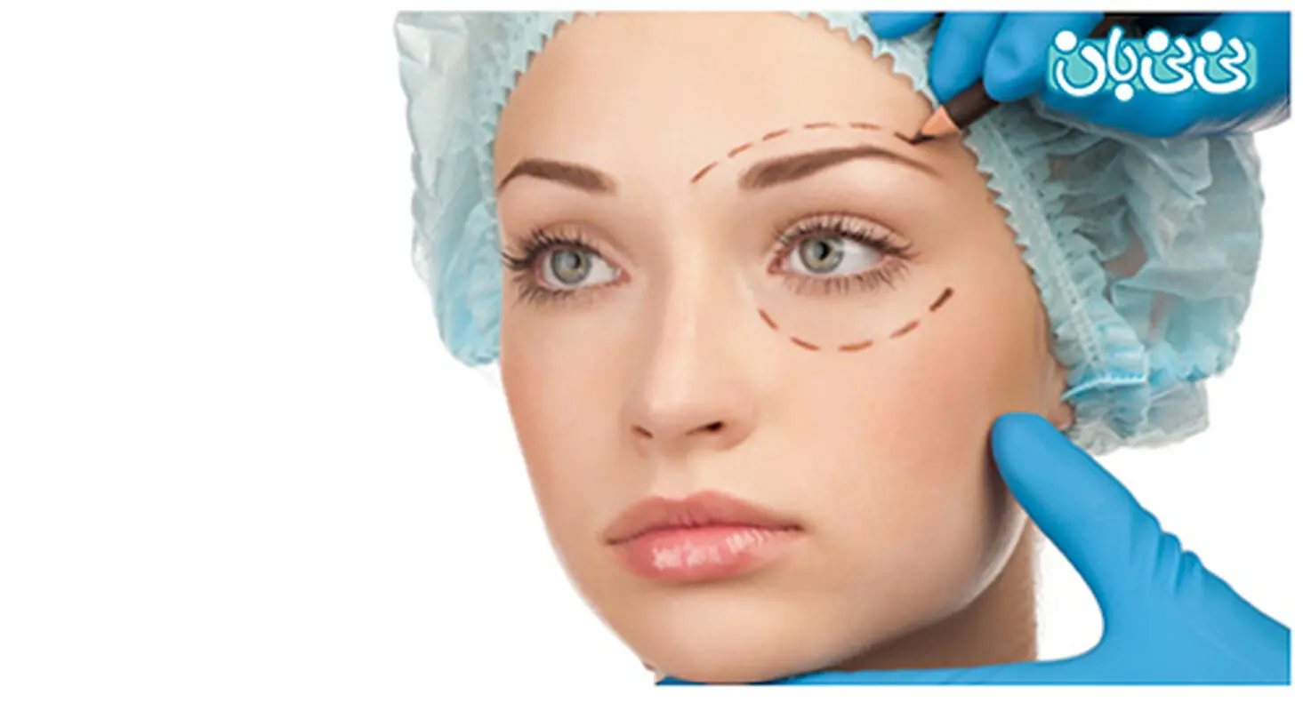 جراحی پلک چیست، هزینه آن چقدر است؟