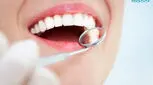 کامپوزیت ونیر یا لمینت؟ کدام روش بهتر است؟